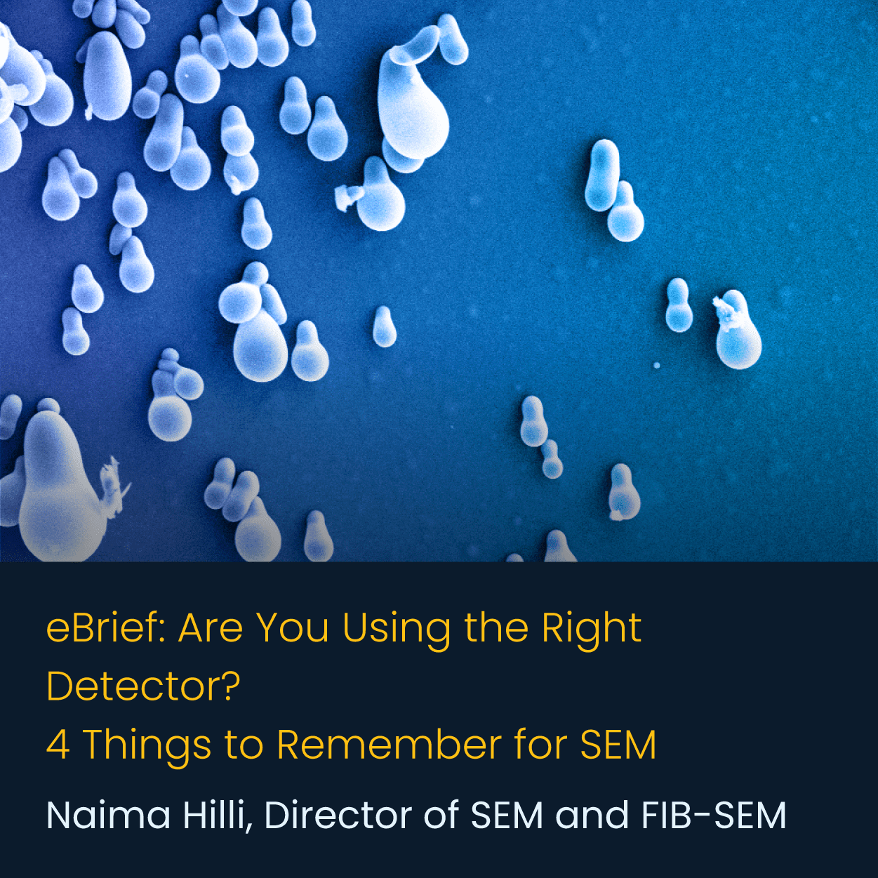 Are You Using the Right Detector? 4 Things to Remember for SEM